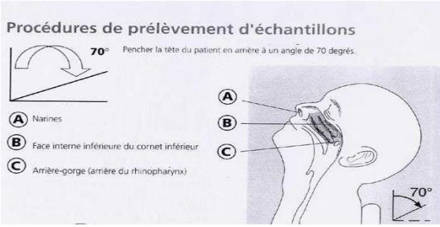 prelevement nasopharynge